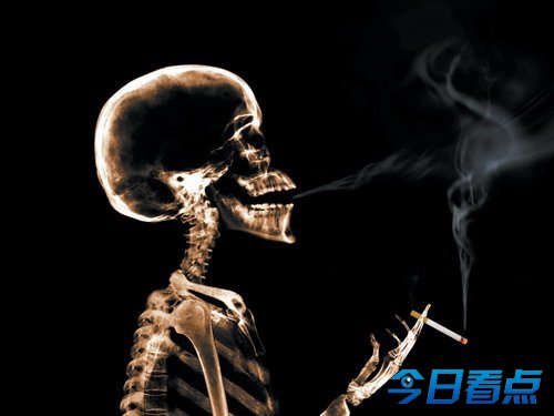 我国12年后将成肺癌第一大国 吸烟系主因