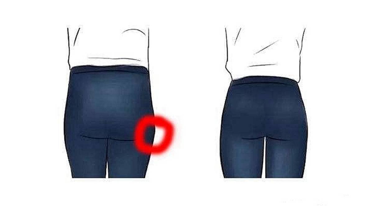 “妇女胯”和“少女胯”有啥区别？怎样才能重回少女胯？