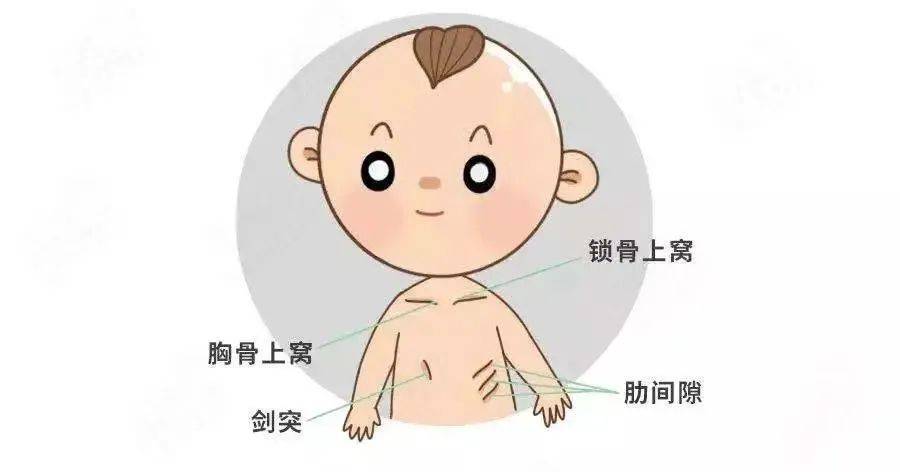 宝宝喉咙呼噜呼噜响一定是有痰吗？可能是喉软骨软化,严重可能窒息