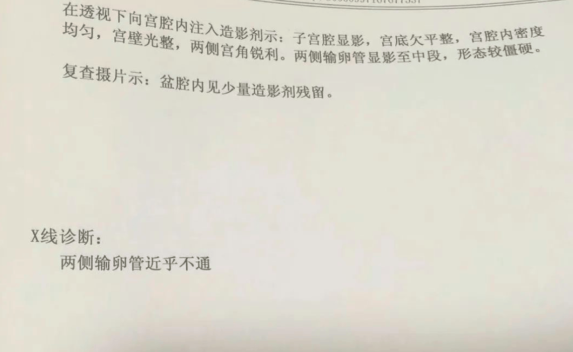 不打麻药取卵针戳进卵巢,我疼不欲生,丈夫在看＂黄片＂取精
