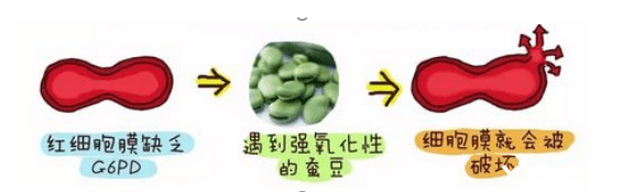 蚕豆病可以根治吗(蚕豆病西药、中药治疗方法)
