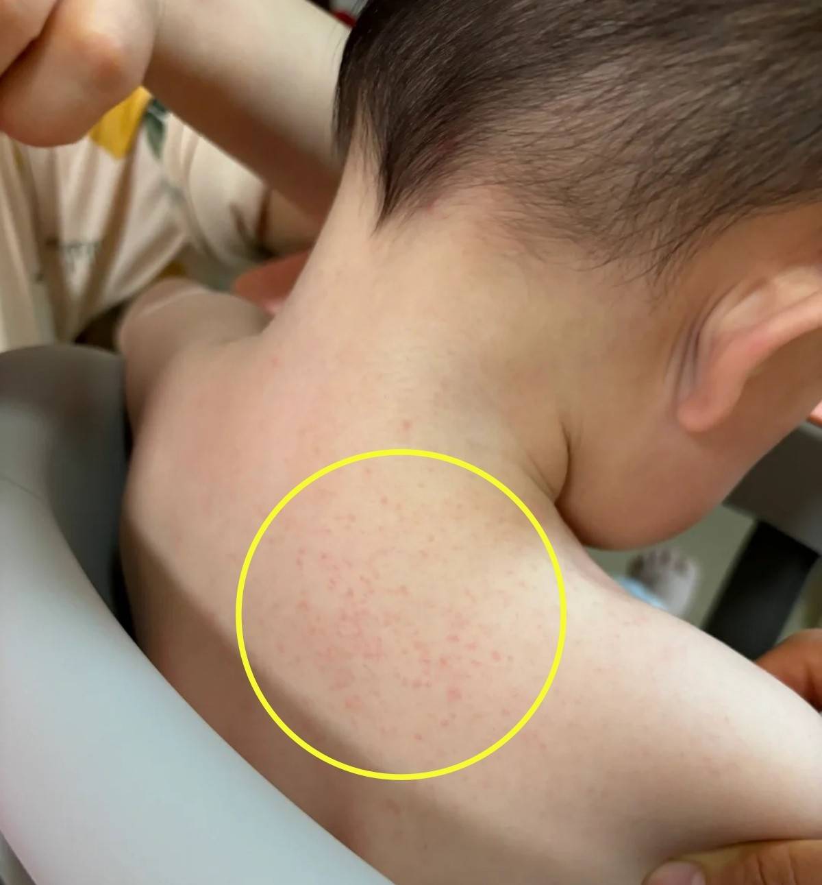 立秋后宝宝要注意什么(宝宝秋天长痱子是什么原因)
