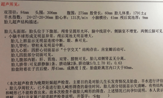 小排畸检查需要注意什么(做小排畸怎么才能让宝宝配合)