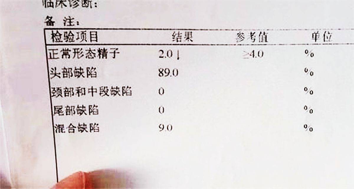 备孕了两年还是没有消息,怎么回事呢？附科学备孕和孕期指南
