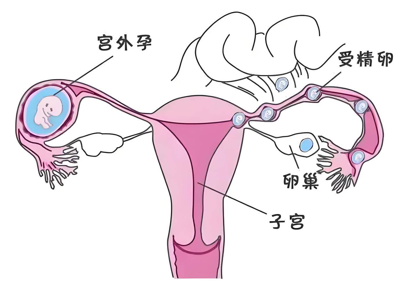 十月怀胎 胎儿每月有一怕,孕妈妈一定要上点心了!