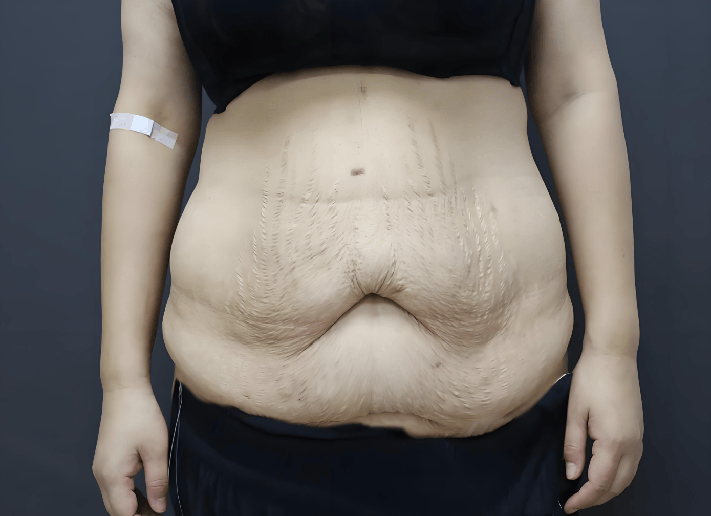 30岁女性生孩子后怎么恢复身材？