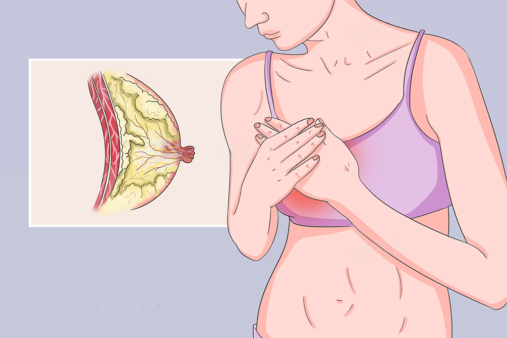 乳头有点疼是来月经还是怀孕