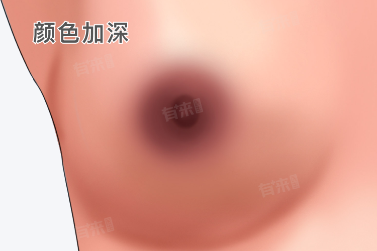 假性怀孕的症状有哪些？如何判断是真怀孕还是假性怀孕