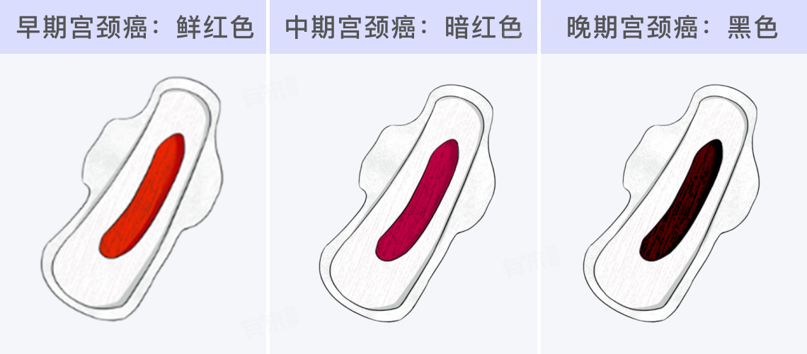 宫颈癌同房出血什么颜色？