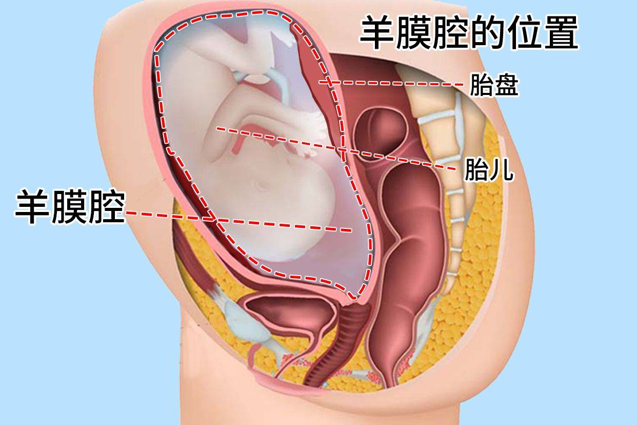 子宫里的水为什么要叫"羊水", 而不是"人水",或者其他的水?