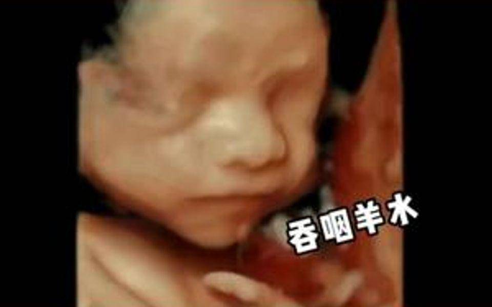 子宫里的水为什么要叫"羊水", 而不是"人水",或者其他的水?