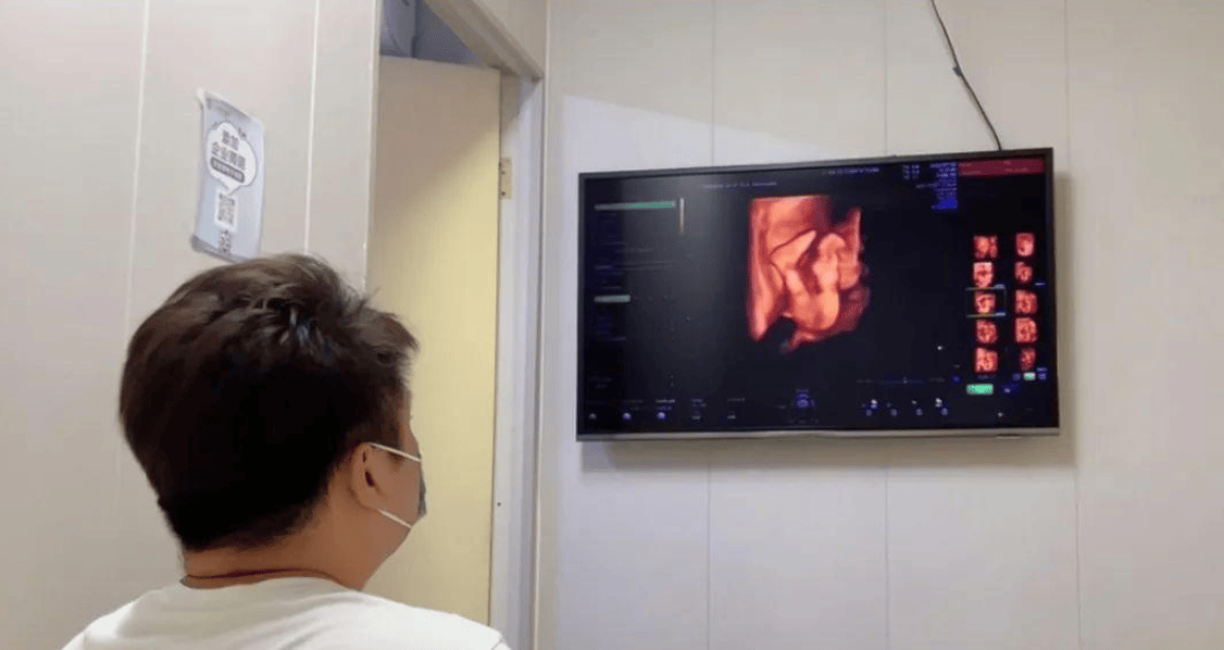 孕晚期胎动像心跳一样是怎么回事?可能是胎儿在打嗝