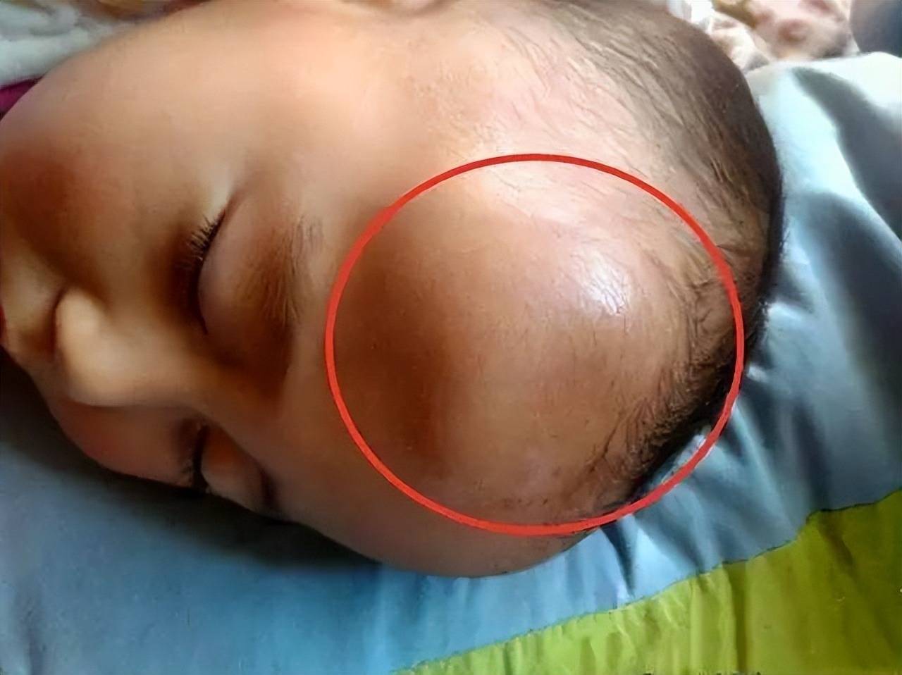 宝宝摔下床后,别急着立刻扶起来,了解"黄金十秒"很重要