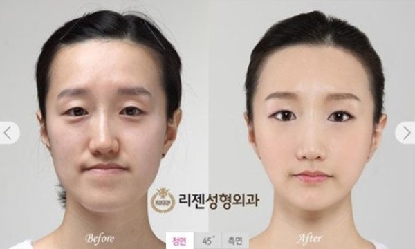 一下年轻三十岁…… - 搞笑图片,整容,韩国,搞笑图片,幽默笑话,搞笑段子,爆笑图片