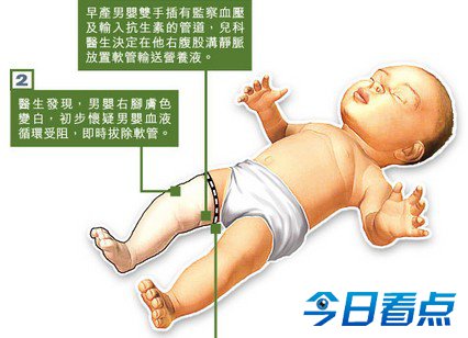 男婴被父母遗弃遭医院开死亡证明 火化前活了