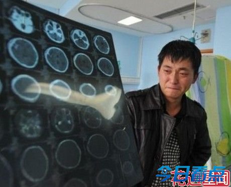 被摔男婴能进食将开颅 虐婴女带来的反思