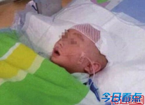 被摔男婴能进食将开颅 虐婴女带来的反思