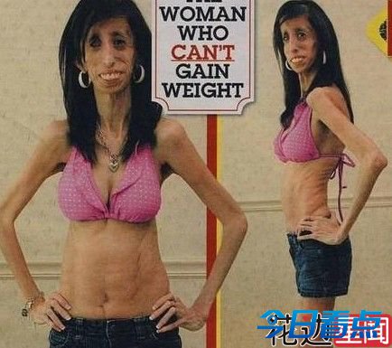 零脂肪女孩成演讲师励志感人 一天吃60顿为保命