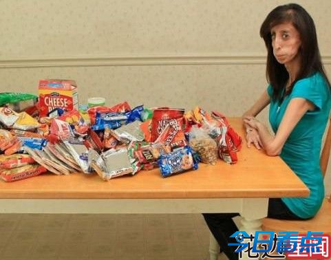 零脂肪女孩成演讲师励志感人 一天吃60顿为保命