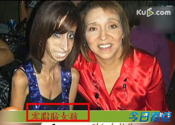最美马拉松女孩VS零脂肪女孩 谁更强