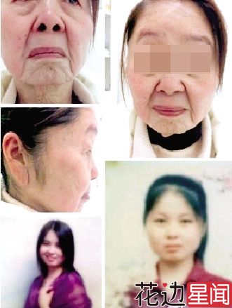 妙龄女子分娩半年变"老太太" 不敢照镜子