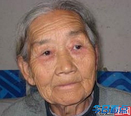 妙龄女子分娩半年变"老太太" 不敢照镜子