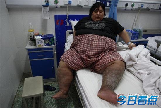 长沙35岁男子体重400多斤腰围170cm 染重病父母亡