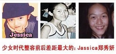 郑氏姐妹容颜进化史 西卡变化大疑整容