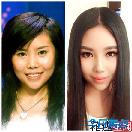纪敏佳一秒变angelababy 女星整容犹如换张脸