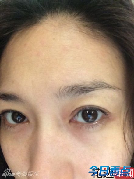 38岁李小冉半夜晒素颜 眼袋吓人满脸雀斑