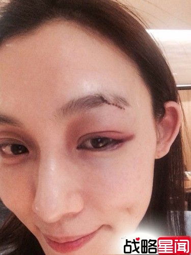 范玮琪怀孕3月暗示宝宝性别 产检报平安
