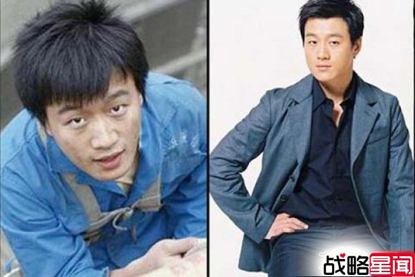 林志玲毁容丑照惊曝光 眼凸面干吓呆网友